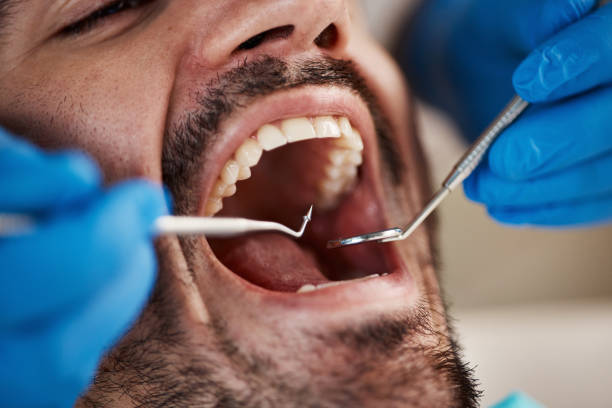 Best Emergency Treatment for Dental Infections or Abscesses in Finderne, NJ